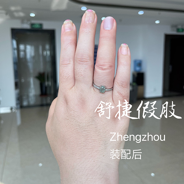 美容假手指裝配后效果，根本看不出來(lái)